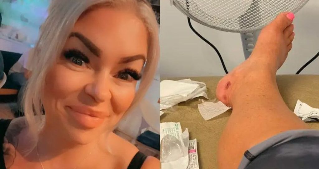 İngiliz kadının Bodrum’daki lüks otelde yaptığı tatil ülkesine dönünce kabusa döndü… ingiliz-kadinin-bodrumdaki-luks-otelde-yaptigi-tatil-ulkesine-donunce-kabusa-dondu-EW7mAPKi.jpg