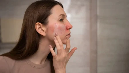 Kış aylarında görülen deri hastalıklarına dikkat! kis-aylarinda-gorulen-deri-hastaliklarina-dikkat-yAWkpHqT.jpg