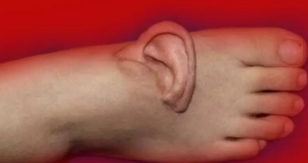 Kopan kulagini ayagina diktiler s89aunzX.jpg