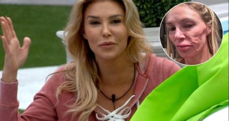 Ünlü televizyon yıldızının yüzü tanınmaz hale geldi! Unlu televizyon yildizinin yuzu taninmaz hale geldi tFn7tNRO.jpg