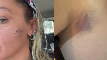 Yıldız Asyalı eşinden şiddet gördüğünü açıkladı Yildiz asyali esinden siddet gordugunu acikladi AvjXCnTq.jpg