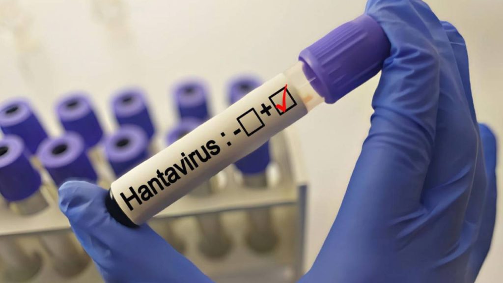 Uzmanlardan ‘hantavirüs’ açıklaması uzmanlardan-hantavirus-aciklamasi-tFZU9ZtH.jpg
