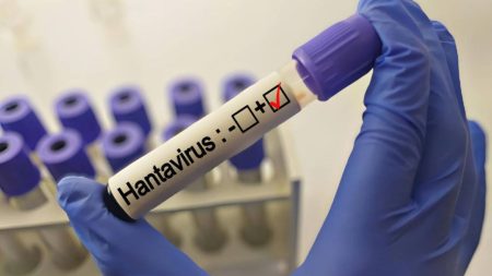 Uzmanlardan ‘hantavirüs’ açıklaması