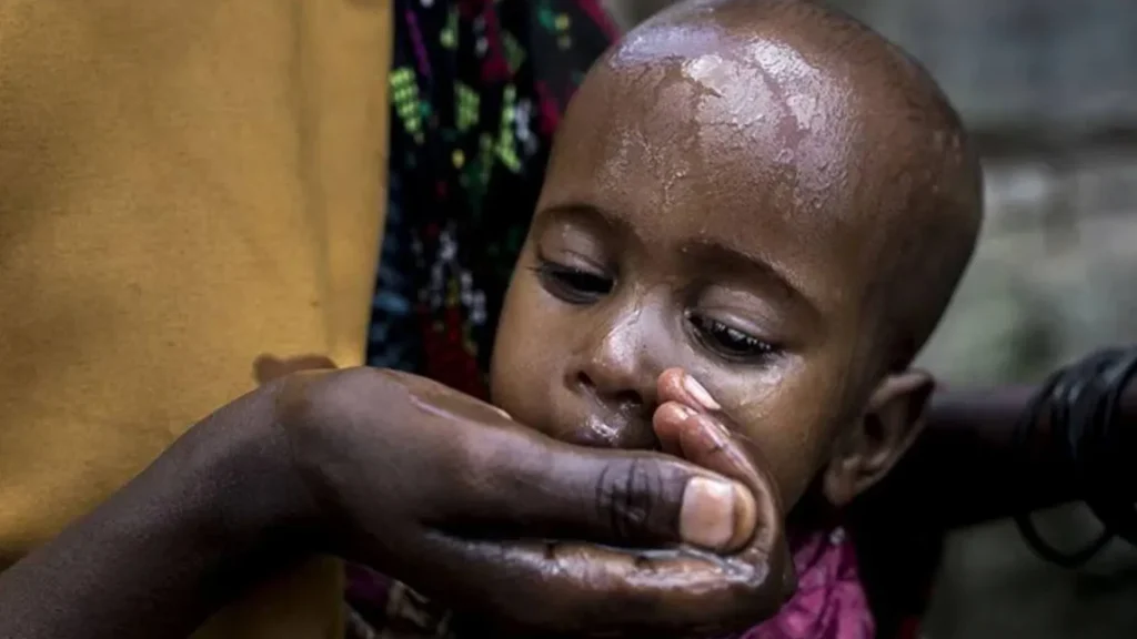 Afrika’da 400 milyondan fazla kişi içme suyuna erişemiyor Afrika’da 400 milyondan fazla kişi içme suyuna erişemiyor