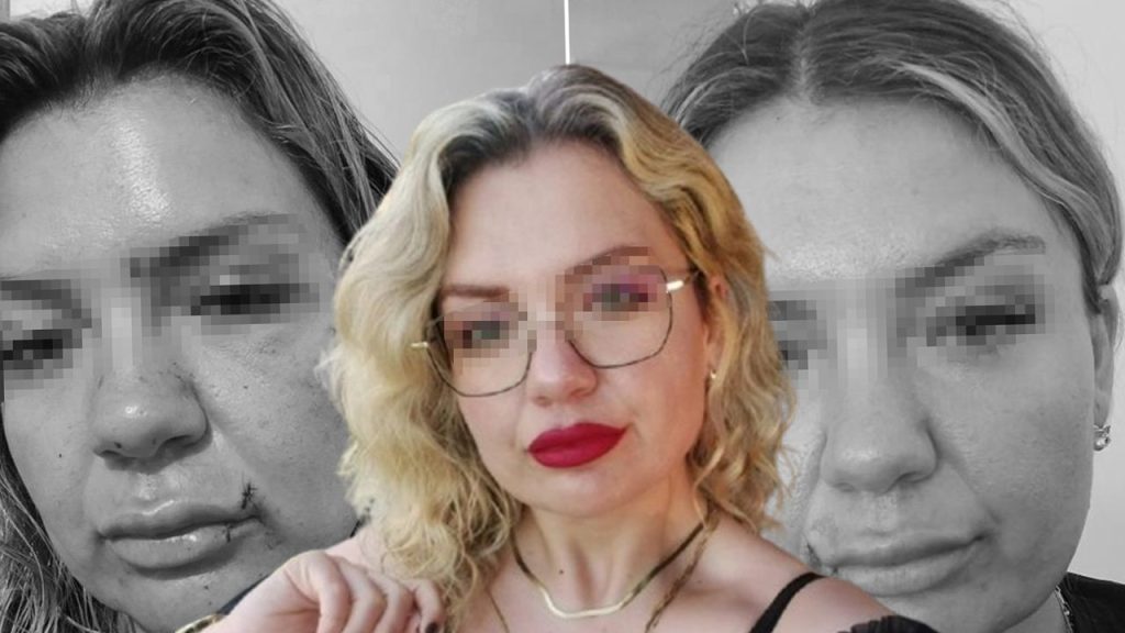 “Bugün büyük gün” diyerek aradı dehşeti yaşattı: Bıçak sırtında kırıldı “Bugün büyük gün” diyerek aradı dehşeti yaşattı: Bıçak sırtında kırıldı